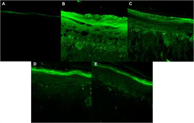 Evaluation of the photoprotective and antioxidant potential of an avobenzone derivative